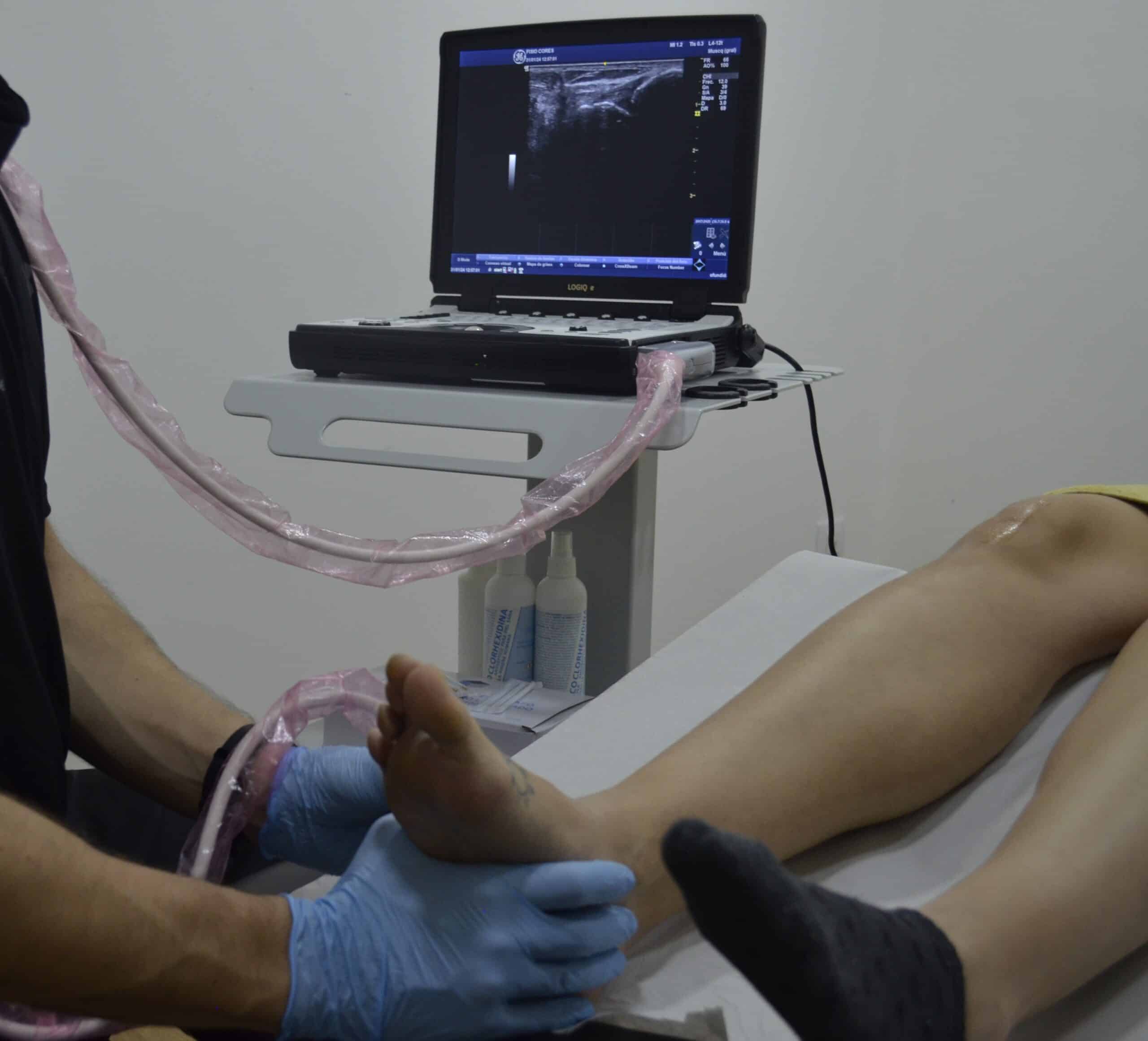 Técnica de recuperación de tejido